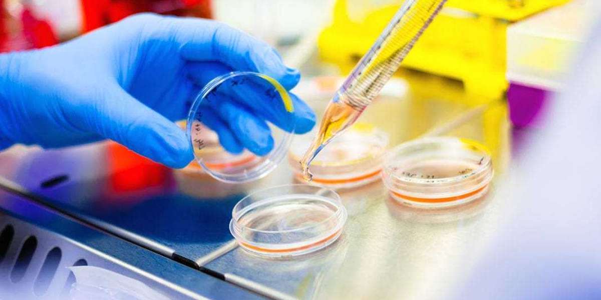 Cell Therapy Approaches for Multiple Sclerosis Patients